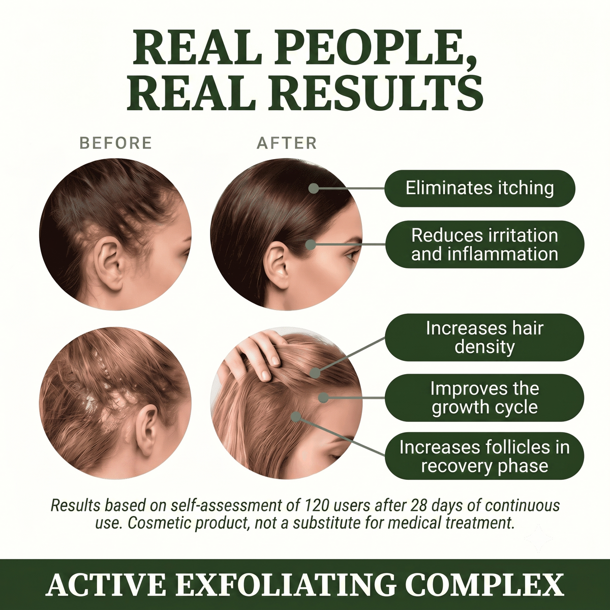 ROOTLIFT™ Natural Scalp Exfoliating Treatment