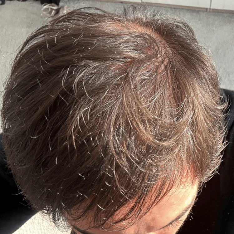 After
